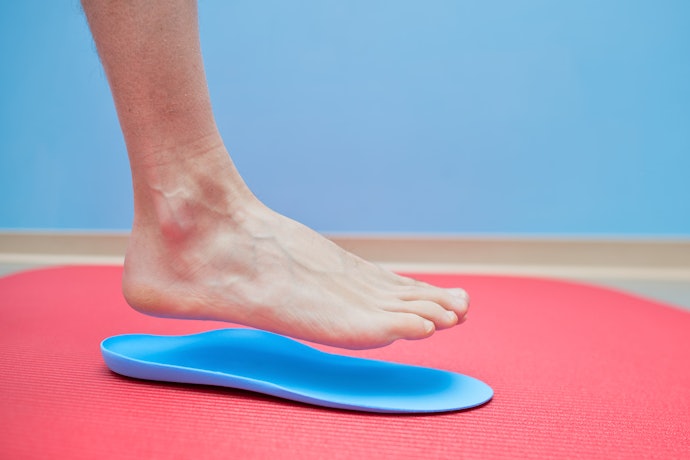 What Are Flat Feet and How Can Insoles Help?